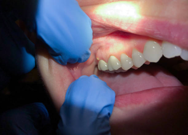 Best Urgent Tooth Repair  in Jewett City, CT
